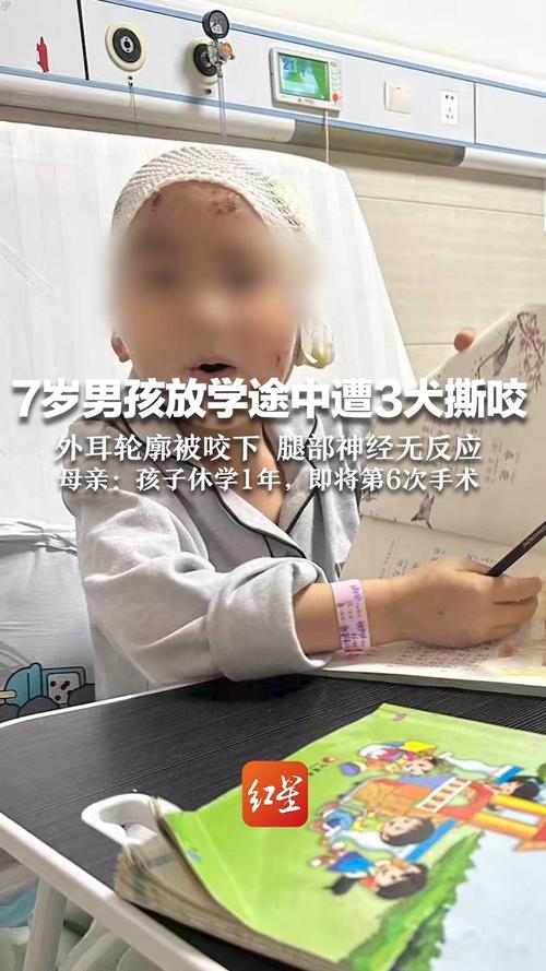 澳彩资料免费提供资料:7岁男孩遭3只犬撕咬
